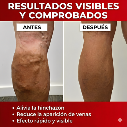 VenoActive® – Crema para Varices